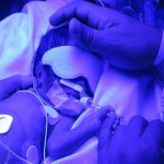 Antifaz para protección ocular, neonatal (paquete con 5 piezas) BEL-FOT-ANT-5T MARCA -  Bhelius