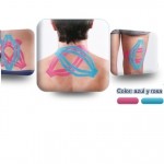 Maxtaping A + plus 22 cm, paquete con 4 piezas OPO-8095-L MARCA -  Oppo Medical